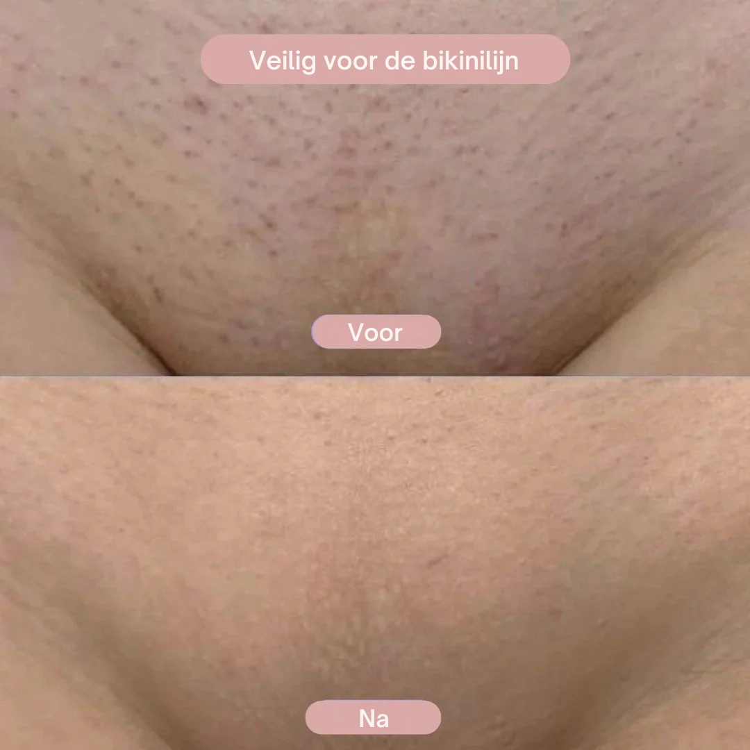 SilkPro™ - 2-in-1 Scheerapparaat voor Vrouwen